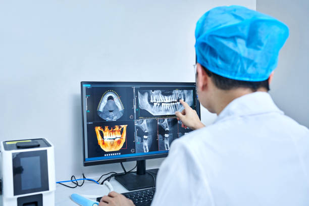 Best Emergency Dental Care for Broken or Chipped Teeth in Meadowbrook, CA
